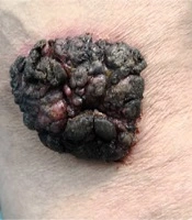 J Skin Stem Cell